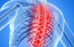 强直性脊柱炎是由什么引起的?